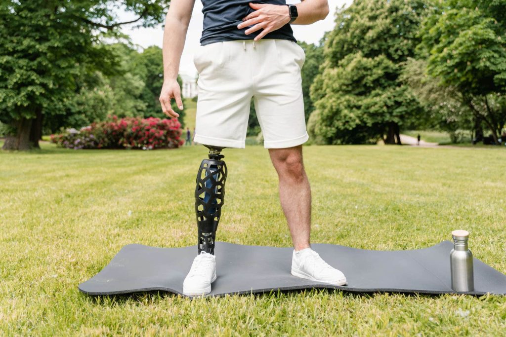 Person with prosthetic leg